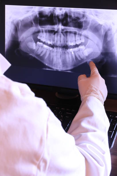 Best Emergency Root Canal Treatment in Terville, WA